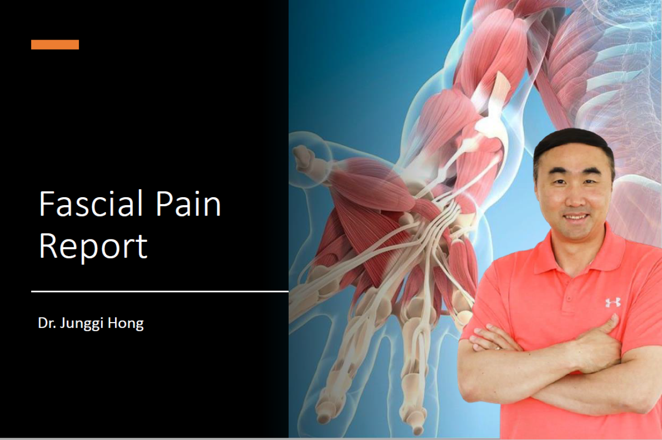 Fascial Pain Report